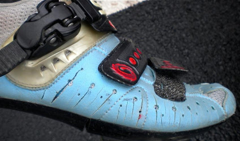 Cycling Shoe Surgery