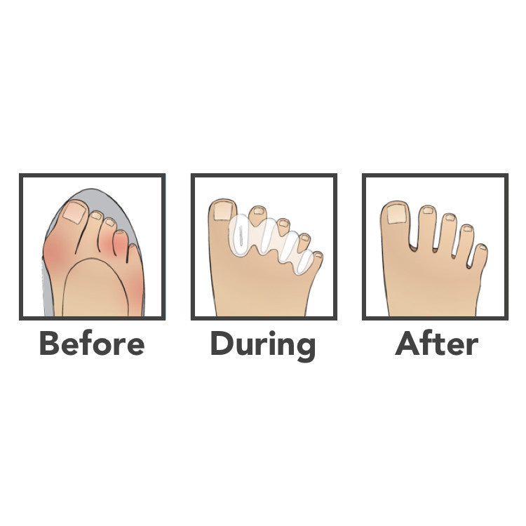 Toe Proper Correct Toes Original Clear | Natural Footgear